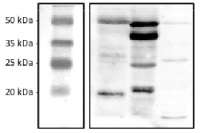 CGL78 | YCF54 in the group Antibodies Plant/Algal / Photosynthesis / GreenCut at Agrisera AB (Antibodies for research) (AS10 936)
